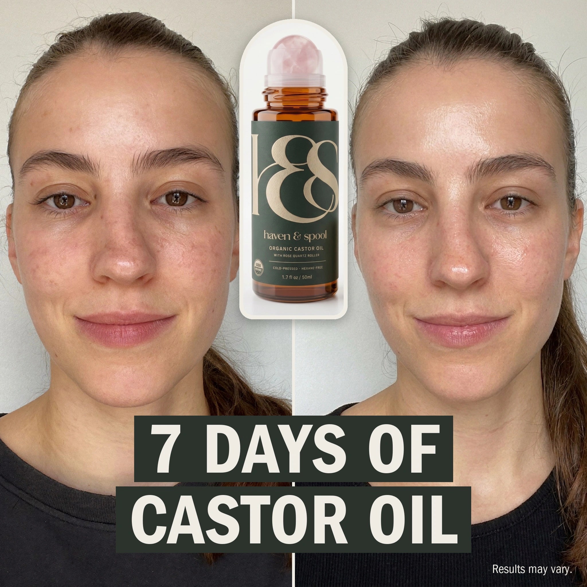 The same woman before and after 7 days of nightly use. Her skin looks less dry and red. Results may vary.