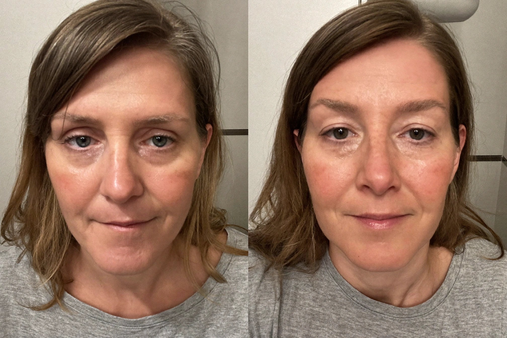 Two morning selfies of the same customer three weeks apart