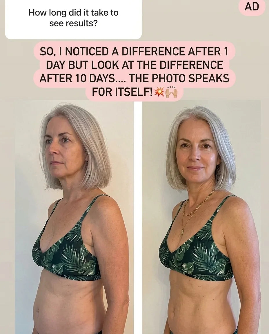 Before and after phone photos of a woman in her late fifties, day 1 with a slight bloat and day 10 with a calm, flat stomach